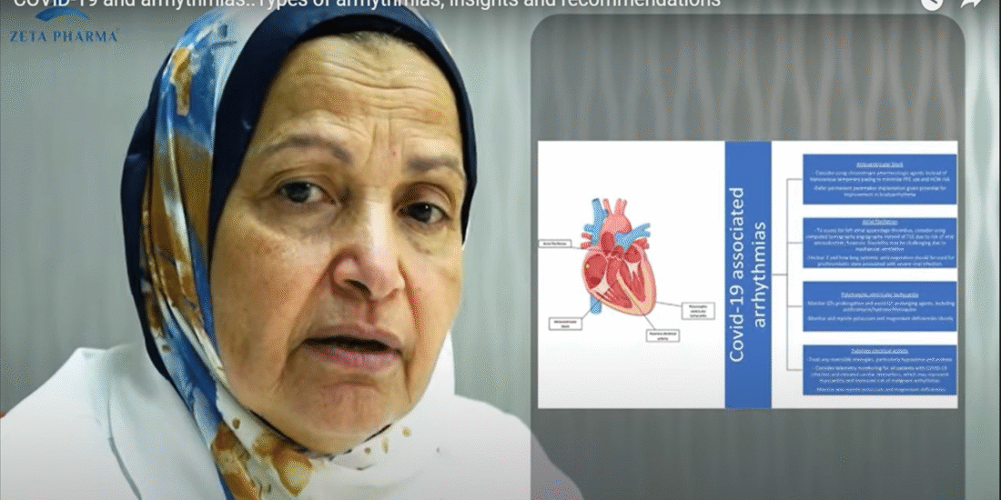 Covid-19 and arrhythmias